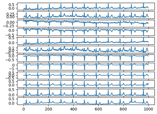 Heart Disease Classification with Electrocardiogram